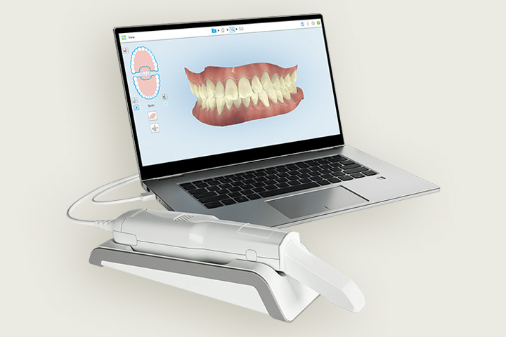 ３D口腔内スキャナーでお口の状態をデジタル化