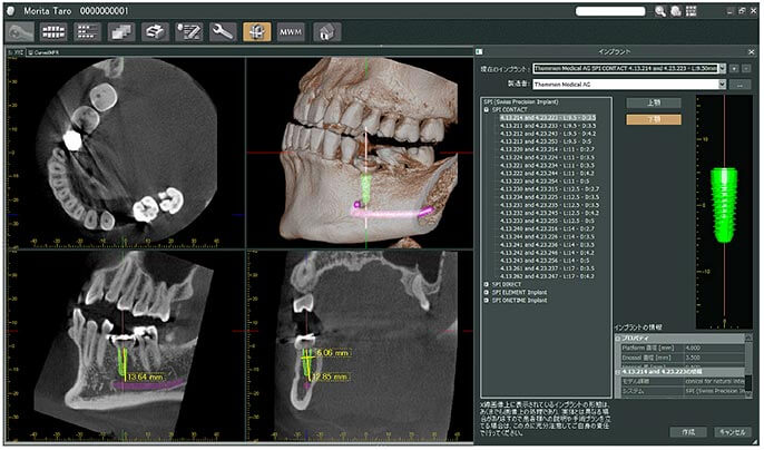歯科用「3DパノラマCT撮影装置」